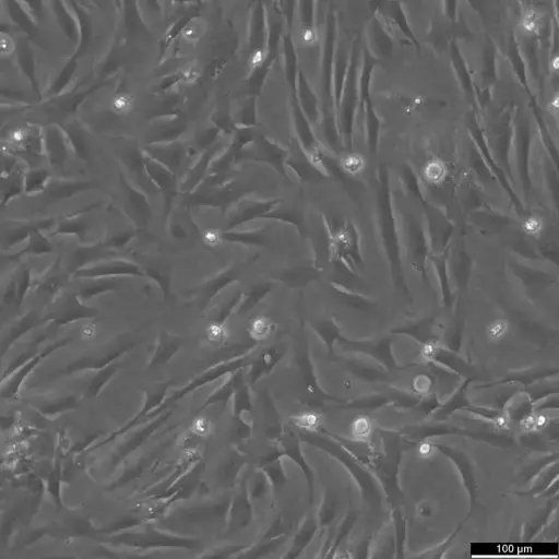 [GENT305222MA] BJ Fibroblast Cells